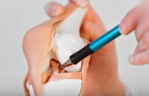 6 foods that silently drain calcium from the body, the more you eat, the weaker your bones become