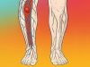 Thrombosis: What It Is, How to Identify Its Symptoms, and Prevent It Naturally